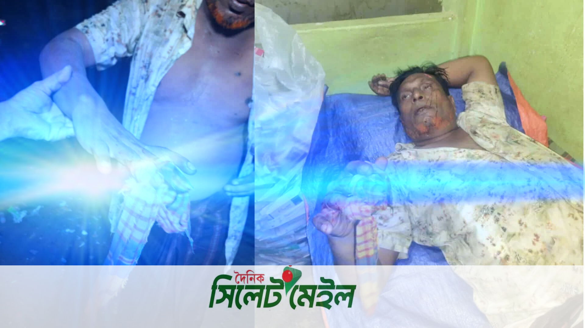 গোয়াইনঘাটে জমি দখলকে কেন্দ্র করে ব্যবসায়ীর উপর হামলা ও লুটের অভিযোগ